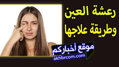 رفة العين وعلاجها