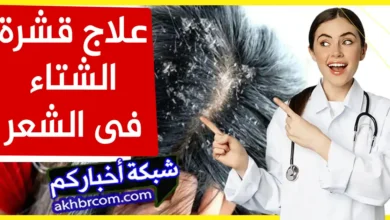 علاج قشرة الشتاء فى الشعر