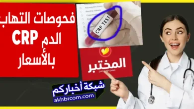 فحوصات التهاب الدم CRP