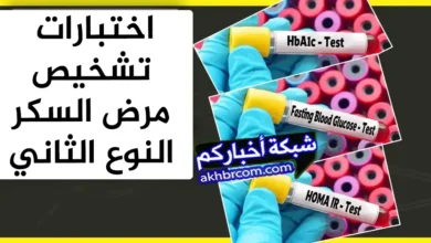 اختبارات تشخيص مرض السكر النوع الثاني