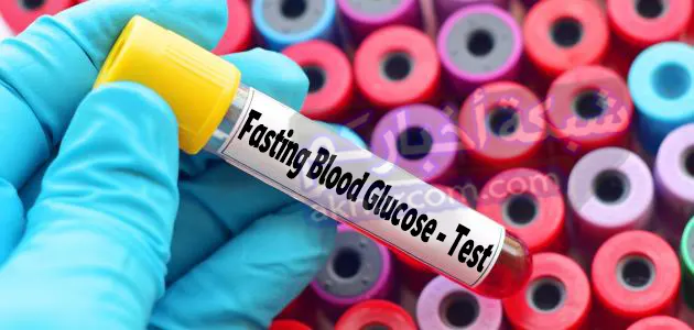 اختبارات تشخيص مرض السكر النوع الثاني