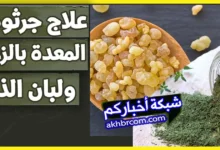 علاج جرثومة المعدة بالزعتر ولبان الذكر