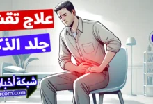 علاج تقشر جلد الذكر